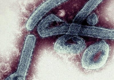 Marburg virus